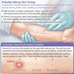 Decoding Penicillin Allergy Testing: Why Europe and America Skip Skin Tests