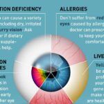 Understanding Your Eye Health: A Casual Guide to Common Issues and Solutions 2024